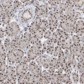 Anti-SF3A3 antibody produced in rabbit Prestige Antibodies® Powered by Atlas Antibodies, affinity isolated antibody, buffered aqueous glycerol solution