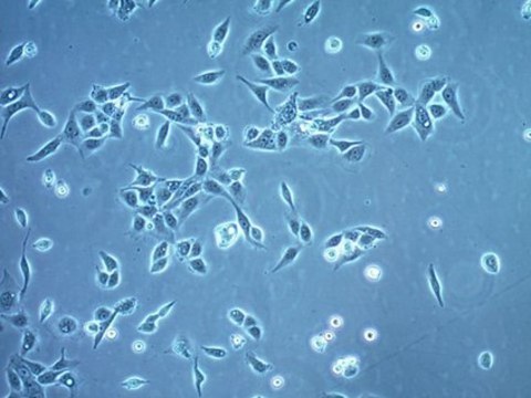 OECM-1 Human Oral Squamous Carcinoma Cell Line OECM-1 human oral squamous carcinoma cell line is suitable for studies of cancer cell signaling, epithelial-mesenchymal transition (EMT), metastasis, invasion, and cancer cell stemness.