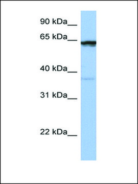 Anti-POPDC2 antibody produced in rabbit affinity isolated antibody