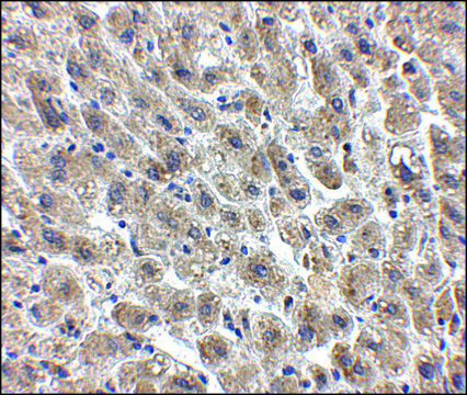 Anti-Albumin antibody produced in chicken affinity isolated antibody, buffered aqueous solution