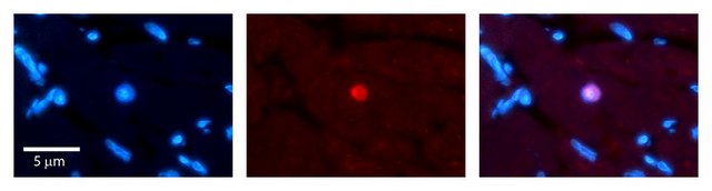 Anti-RING1 (ab2) antibody produced in rabbit affinity isolated antibody