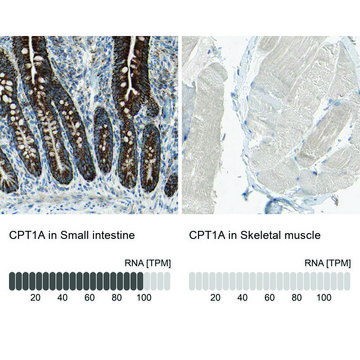 Anti-CPT1A antibody produced in rabbit Prestige Antibodies&#174; Powered by Atlas Antibodies, affinity isolated antibody, buffered aqueous glycerol solution