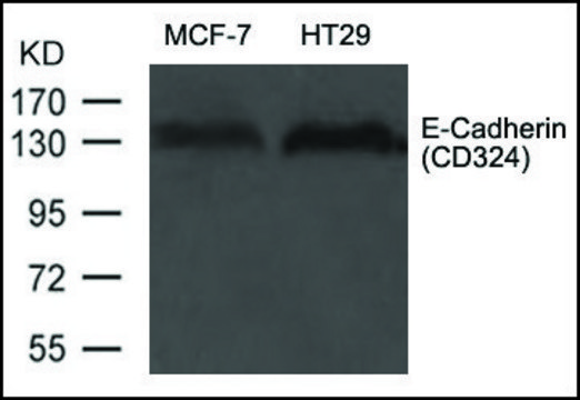 Anti-CDH1 antibody produced in rabbit affinity isolated antibody