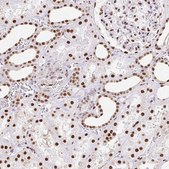 Anti-SET antibody produced in rabbit Prestige Antibodies® Powered by Atlas Antibodies, affinity isolated antibody, buffered aqueous glycerol solution