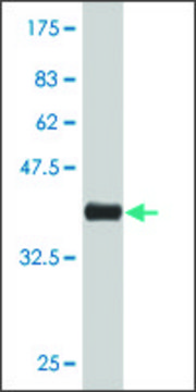 Monoclonal Anti-VMD2 antibody produced in mouse clone 1C2, purified immunoglobulin, buffered aqueous solution