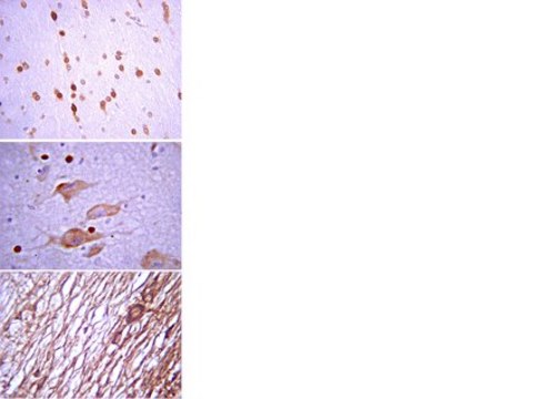 Anti-Vesicular GABA Transporter Antibody serum, from rabbit