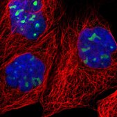 Anti-RRP1 antibody produced in rabbit Prestige Antibodies® Powered by Atlas Antibodies, affinity isolated antibody, buffered aqueous glycerol solution, Ab1