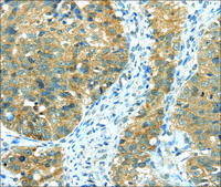 Anti-TRIB1 affinity isolated antibody