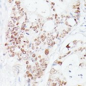 Anti-p53 antibody produced in rabbit