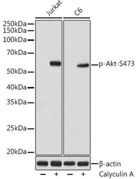 Anti-Phospho-Akt-S473 antibody produced in rabbit