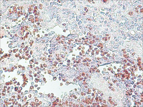 Anti-Histone Deacetylase 2 (HDAC2) antibody produced in rabbit IgG fraction of antiserum, buffered aqueous solution