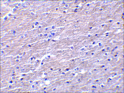 Anti-Clusterin antibody produced in rabbit affinity isolated antibody, buffered aqueous solution