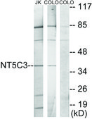 Anti-NT5C3 antibody produced in rabbit affinity isolated antibody