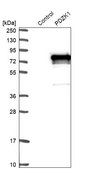 Anti-PDZK1 antibody produced in rabbit Prestige Antibodies® Powered by Atlas Antibodies, affinity isolated antibody, buffered aqueous glycerol solution, Ab1