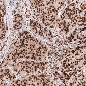 Monoclonal Anti-Bcor Antibody Produced In Mouse Prestige Antibodies® Powered by Atlas Antibodies, clone CL13841, affinity isolated antibody, buffered aqueous glycerol solution