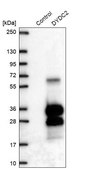 Anti-DYDC2 antibody produced in rabbit Prestige Antibodies® Powered by Atlas Antibodies, affinity isolated antibody, buffered aqueous glycerol solution
