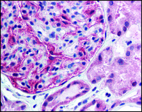 Anti-FANCF antibody produced in rabbit affinity isolated antibody, buffered aqueous solution