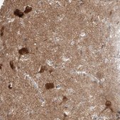 Anti-STXBP6 antibody produced in rabbit Prestige Antibodies® Powered by Atlas Antibodies, affinity isolated antibody, buffered aqueous glycerol solution