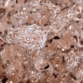 Anti-WFDC2 antibody produced in mouse Prestige Antibodies® Powered by Atlas Antibodies, clone CL12917, purified by using Protein A, buffered aqueous glycerol solution
