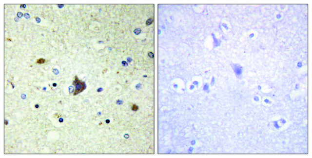 Anti-Collagen IV &#945;3 antibody produced in rabbit affinity isolated antibody