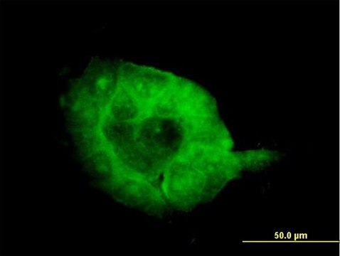 Monoclonal Anti-SH3BP2 antibody produced in mouse clone 1E9, purified immunoglobulin, buffered aqueous solution