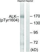 Anti-ALK (Phospho-TYR1604) affinity isolated antibody