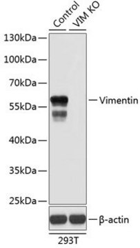 Anti-Vimentin antibody produced in rabbit