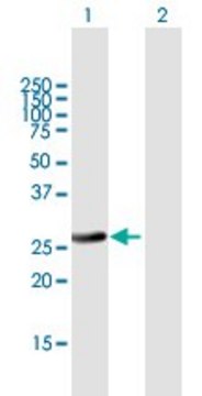 Anti-RAB32 antibody produced in mouse purified immunoglobulin, buffered aqueous solution