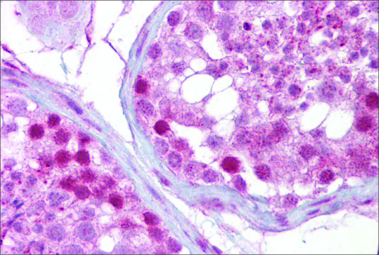 Anti-IFT88 antibody produced in rabbit affinity isolated antibody