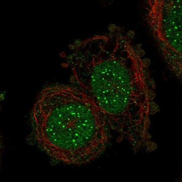 Anti-Cenpi Antibody Produced In Rabbit Prestige Antibodies&#174; Powered by Atlas Antibodies, affinity isolated antibody, buffered aqueous glycerol solution