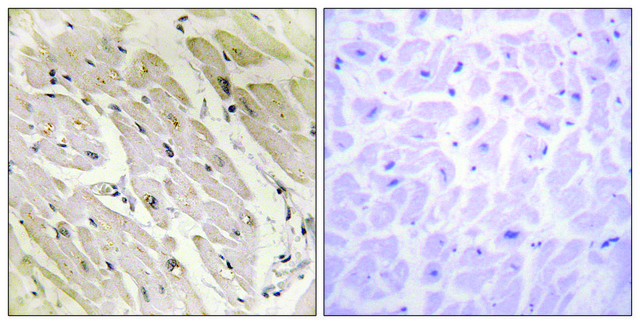 Anti-PRKAG2 antibody produced in rabbit affinity isolated antibody