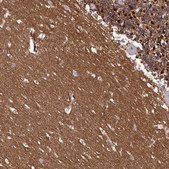 Anti-FXYD6 antibody produced in rabbit Prestige Antibodies® Powered by Atlas Antibodies, affinity isolated antibody, buffered aqueous glycerol solution