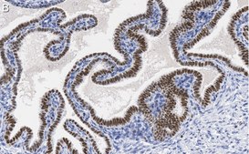 Anti-SOX17 Antibody, clone 3F7, ZooMAb&#174; Rabbit Monoclonal recombinant, expressed in HEK 293 cells