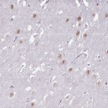 Anti-PTCHD1 antibody produced in rabbit Prestige Antibodies&#174; Powered by Atlas Antibodies, affinity isolated antibody, buffered aqueous glycerol solution