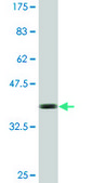 Monoclonal Anti-CCDC5, (C-terminal) antibody produced in mouse clone 1E3, purified immunoglobulin, buffered aqueous solution