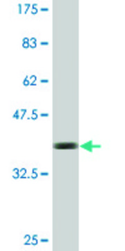 Monoclonal Anti-CCDC5, (C-terminal) antibody produced in mouse clone 1E3, purified immunoglobulin, buffered aqueous solution