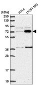 Anti-ZNF800 antibody produced in rabbit Prestige Antibodies® Powered by Atlas Antibodies, affinity isolated antibody