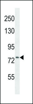 ANTI-CD106 (CENTER) antibody produced in rabbit purified immunoglobulin, buffered aqueous solution