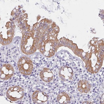 Anti-FPGS antibody produced in rabbit Prestige Antibodies&#174; Powered by Atlas Antibodies, affinity isolated antibody, buffered aqueous glycerol solution