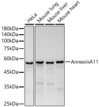 Anti-Annexin A11 Antibody, clone 8O5Z5, Rabbit Monoclonal