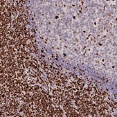 Anti-SAMHD1 antibody produced in rabbit Prestige Antibodies® Powered by Atlas Antibodies, affinity isolated antibody, buffered aqueous glycerol solution