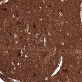 Monoclonal Anti-ID1 antibody produced in mouse Prestige Antibodies® Powered by Atlas Antibodies, clone CL11981, purified immunoglobulin, buffered aqueous glycerol solution