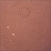 Porcine Pulmonary Artery Endothelial Cells: PPAEC (Cryovial)