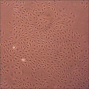 Porcine Pulmonary Artery Endothelial Cells: PPAEC (Cryovial)