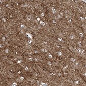 Anti-SLC4A10 antibody produced in rabbit Prestige Antibodies® Powered by Atlas Antibodies, affinity isolated antibody, buffered aqueous glycerol solution