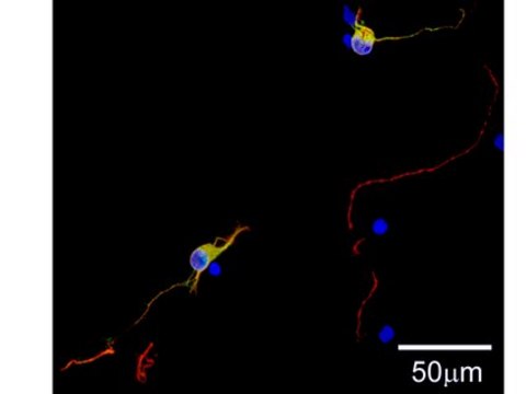 Milli-Mark&#174; ChromaPan Neuronal Marker-ORC Milli-Mark ChromaPan Neuronal Marker-ORC is an antibody targeting the ORC protein, validated for use in ICC &amp; IF.