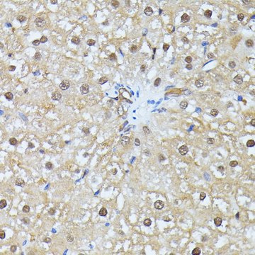 Anti-UBC antibody produced in rabbit