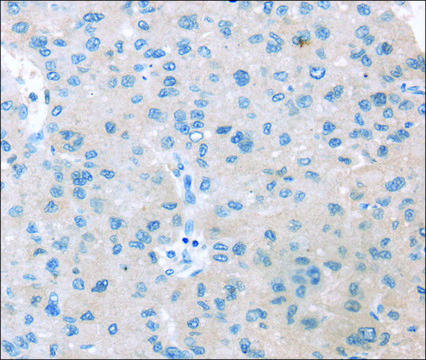 Anti-VPS4B affinity isolated antibody