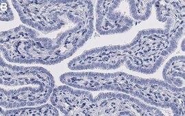 Anti-TYK2 Antibody, clone 2H22 ZooMAb® Rabbit Monoclonal recombinant, expressed in HEK 293 cells