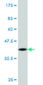 Monoclonal Anti-TLK2 antibody produced in mouse clone 2G7, purified immunoglobulin, buffered aqueous solution